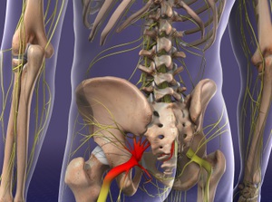 Chiropractic care for sciatica